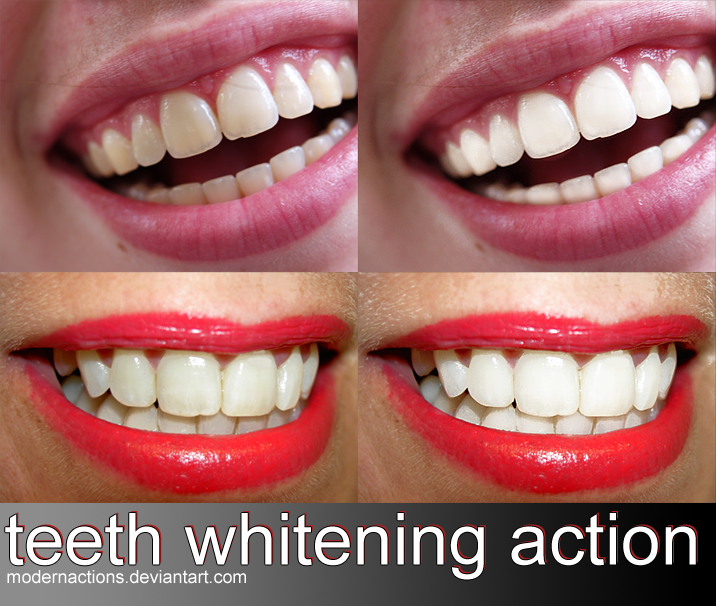 Teeth whitening Photoshop action